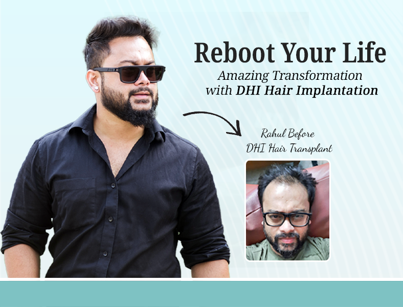 best hair transplant in india