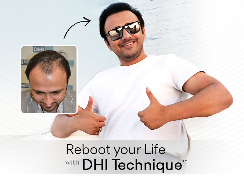 best hair transplant in india