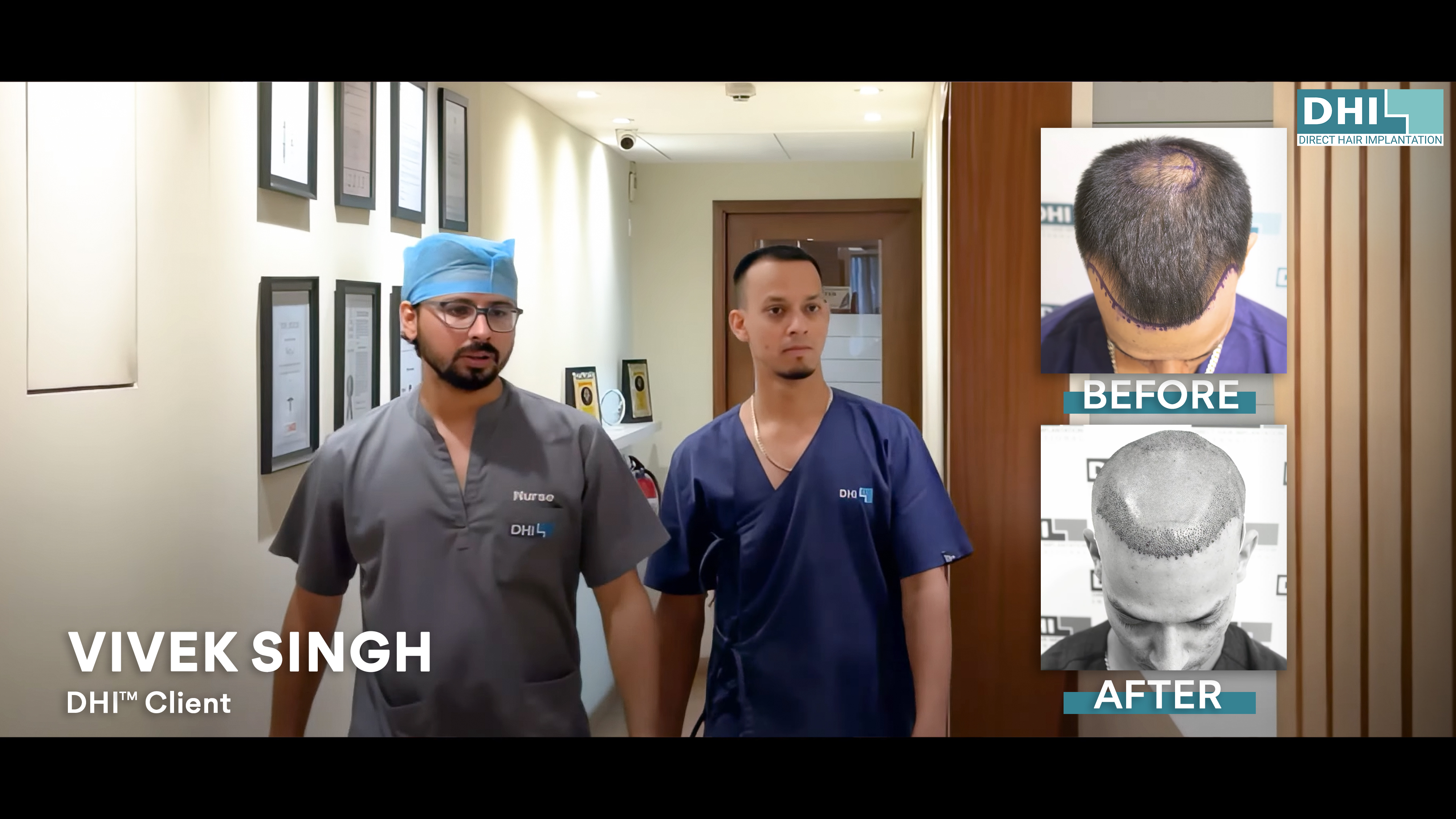 hair transplant video 1