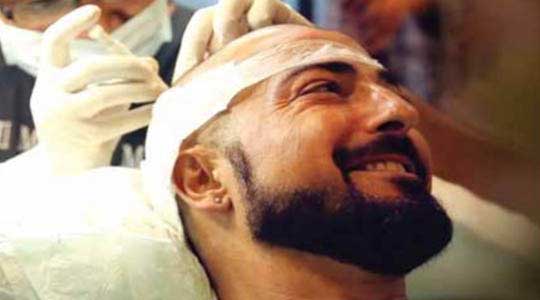10 Best Hair Transplant Centres In Gurgaon  We Are Gurgaon